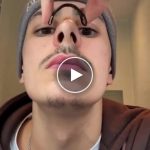 Magnetický nosní dilatátor – video
